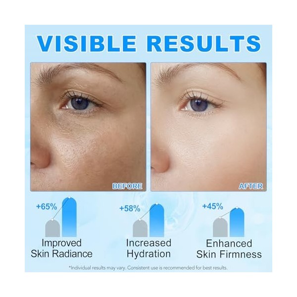 Hyaluronic Acid Powder, 120g Acide Hyaluronique Poudre,Ingrédients hydratants solubles dans leau, acide hyaluronique - soins