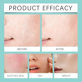 Sérum en capsules dacide hyaluronique 100 g - Sérum hydratant anti-âge pour le visage à lacide hyaluronique pour les ridule A...