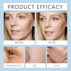 Essence réparatrice anti-rides à lacide hyaluronique 8D, tubes de sérum ultra-hydratant, flacons de sérum ultra-hydratant à ...