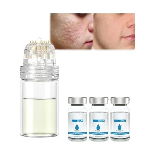 Système de micro-infusion pour le visage, système de micro-infusion pour les lèvres, rouleau de microfléchettes à lacide hya ...