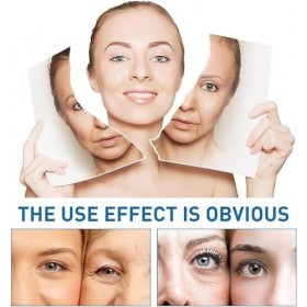 Système de micro-infusion pour le visage, système de micro-infusion pour les lèvres, rouleau de microfléchettes à lacide hya ...