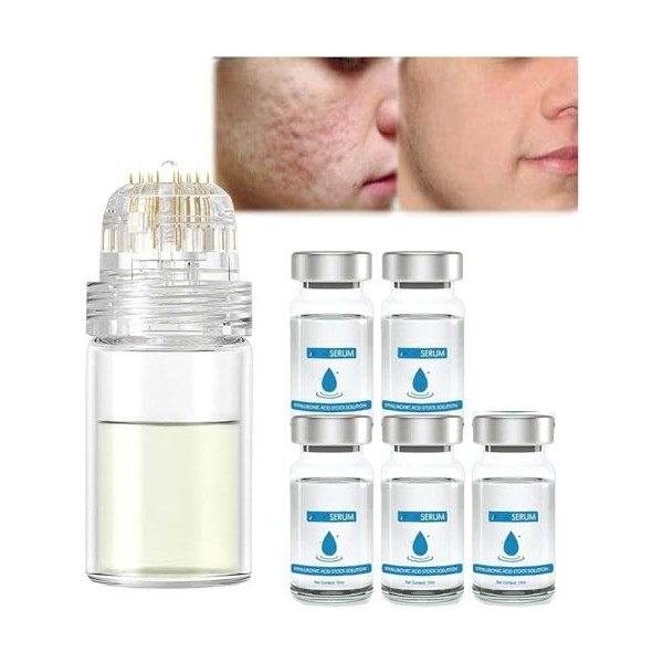Micro Infusion System for Lips | Micro System for Face | Facial System with Serum,Pockmarksheal Hyaluronic Acid Microdart Rol...
