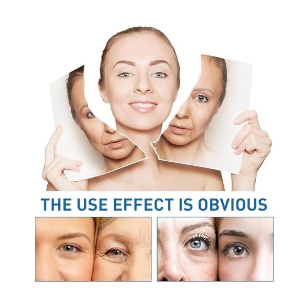 Micro Infusion System for Face | Micro Infusion System for Lips | Pockmarksheal Hyaluronic Acid Microdart Roller,Serum Smooth...