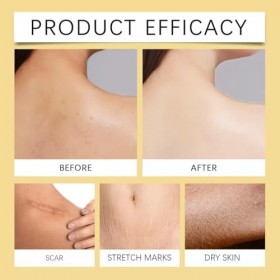 Ha Body Hydrator Sérum pour le corps à lacide hyaluronique 386 ml Pour homme et femme Soin du corps à absorption rapide pour ...