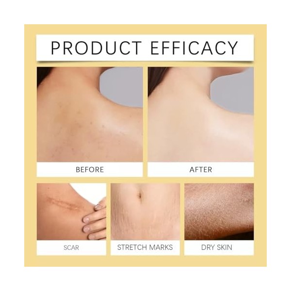 Ha Body Hydrator Sérum pour le corps à lacide hyaluronique 386 ml Pour homme et femme Soin du corps à absorption rapide pour ...