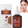 Glutathione Serum with 20,000 ppm Glutathione, Brightening Face Serum with Niacinamide and Hyaluronic Acid, Dark Spot Correct...