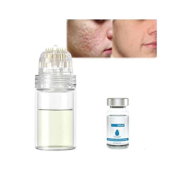 Système de micro-infusion pour le visage, système de micro-infusion pour les lèvres, rouleau de microfléchettes à lacide hya ...