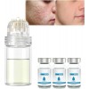 Système de micro-infusion pour le visage, système de micro-infusion pour les lèvres, rouleau de microfléchettes à lacide hya ...