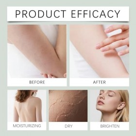 Sérum corporel à lacide hyaluronique - Hydratant corporel intense pour peaux sèches, raffermit et améliore lélasticité, abs A...