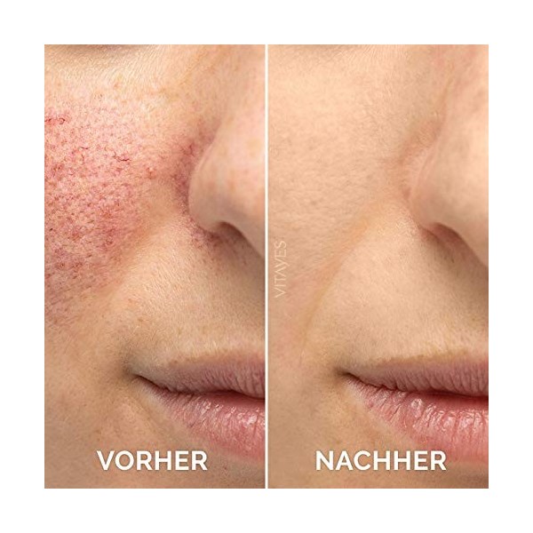 PERFECTOR - Sérum Vitamine C à lAcide Hyaluronique 30 ml-Sérum Visage VITAYES