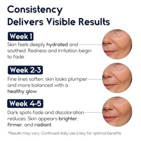 Sérum à lacide hyaluronique pur pour le visage avec vitamine B5, sérum hydratant pour peaux sensibles, sérum anti-âge, sérum