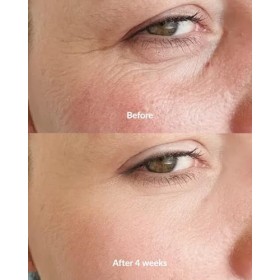 Nejen Supreme Extract Sérum visage anti-âge, avec action régénératrice et ultra liftante, acide hyaluronique à 3 poids molécu