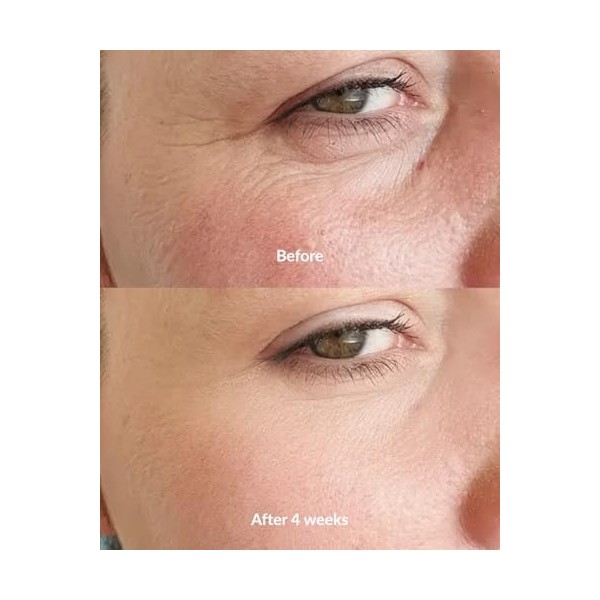 Nejen Supreme Extract Sérum visage anti-âge, avec action régénératrice et ultra liftante, acide hyaluronique à 3 poids molécu