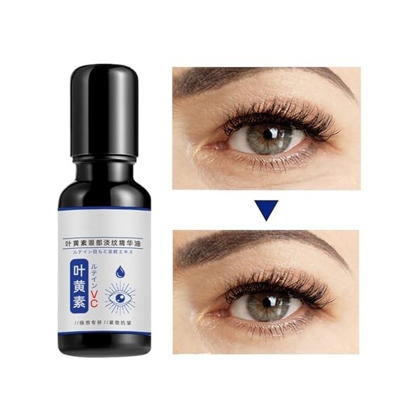 Huile Des Yeux De La Lutéine, Lutéine Les Yeux,Solution Douce Pour La Peau - Huile De De Lutéine Naturelle Pour La Peau Nourr