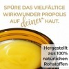 fallea Pommade à la propolis hautement dosée pour lacné, la dermatite atopique, crème contre les démangeaisons, les peaux sè