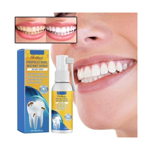 Furzero Propolis Lot de 2 sprays de traitement oral instantané à la propolis pour la santé bucco-dentaire à la propolis Bain 