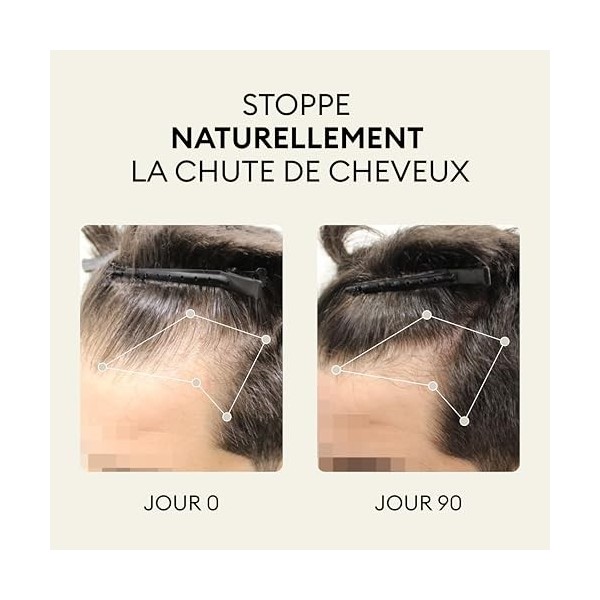 OMA & ME Complément Cheveux Folicaps™ – Anti-Chute Naturel, Croissance Rapide, Volume & Vitalité – Biotine, Zinc, Prêle – Fab...