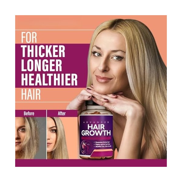 Vitamines pour la croissance des cheveux pour les femmes | Biotine, Collagène, Saw Palmetto | Des cheveux, une peau et des on