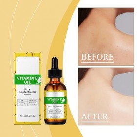 Vitamin E Oil - 75,000 IU, Organic Vitamin E Oil for Cosmetics, Firming Plump Skin, Reducing Fine Lines, Pure Vitamin E Oil f