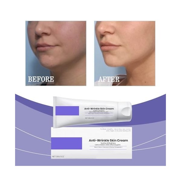 Anti Rides Puissant Immediat,Wrinkle Power,Rétinol Creme Liftante Anti rides Instantané,Combleur de Rides Immediat - Élimine ...