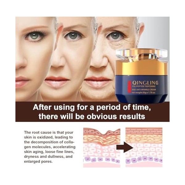 Qinglin CrèMe Rajeunissante, Quinglin Creme Rajeunissante, Qinglin Creme, CrèMe Anti-Rides Qingling, Crèmepour le visage Qing...