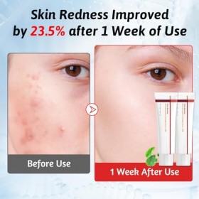 KutaKuta 2 PCS Time Reverse Centella Moisturiser Crème Réparatrice pour le Visage, Centella Asiatica Crème Anti-âge Revitalis