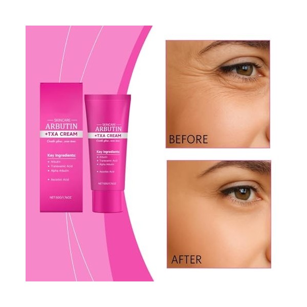 Alpha Arbutin 7 tranexamic acid 4 cream,Crème éclaircissante coréenne, 50 ml, crème hydratante quotidienne pour le visage,tex...