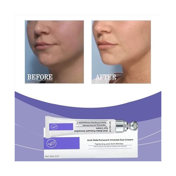 Anti rides puissant immediat,creme lifting immediat visage au Rétinol,combleur de rides,lisseur de rides instantané visage,hy...