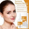 2 Pièces Turmeric Serum Visage Anti Tache Huile De Curcuma Éclaircissant Sérum À Lacide Kojique Et Au Curcuma Atténue Taches