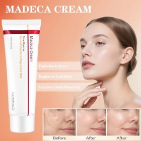 Fengyang® Crème Time Reverse, Anti-rides Et Enrichie En Centella Asiatica, Hydrate Et Raffermit La Peau, Soin Anti-âge Pour T