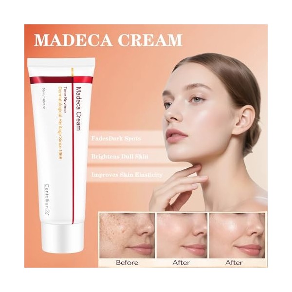 Fengyang® Crème Time Reverse, Anti-rides Et Enrichie En Centella Asiatica, Hydrate Et Raffermit La Peau, Soin Anti-âge Pour T