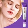 Crème Anti-Hyperpigmentation - Soin Visage Hydratant 20g,Lotion Hydratante, Produit pour lAtténuation des Imperfections Cuta