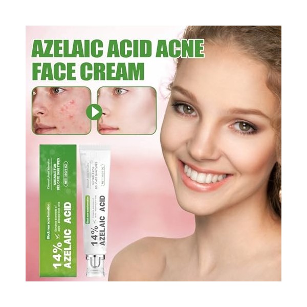 Crème hydratante pour le visage | Élimination des impuretés | Rétrécissement des pores – 30 g Crème Gel Doux Contrôle de lhu