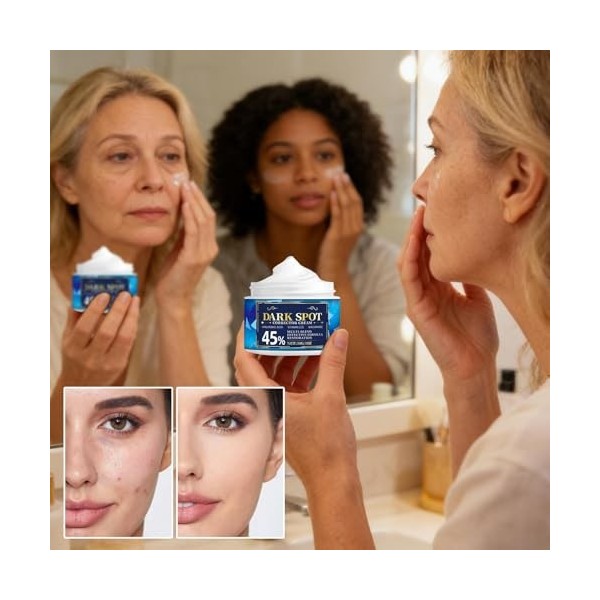 Crème uniforme, crème éclaircissante pour réduire lhyperpigmentation – pour coudes, genoux, mains, jambes, soins quotidiens