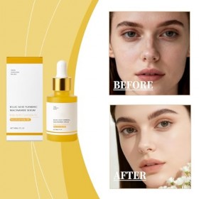 Sérum niacinamide 5 %, sérum éclaircissant les points foncés, minimisant les pores et contrôle de lhuile, crème anti-rides, 