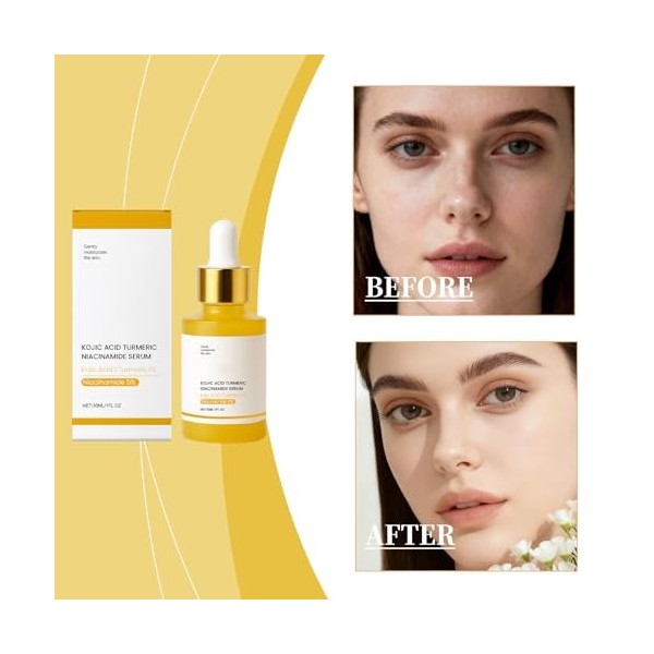 Sérum niacinamide 5 %, sérum éclaircissant les points foncés, minimisant les pores et contrôle de lhuile, crème anti-rides,