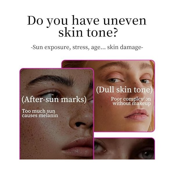 Crème réparatrice pour taches noires，Crème anti-taches de rousseur, réduire les taches brunes,Crème Correctrice Taches Noires