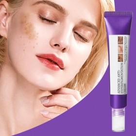 Crème pour le Visage Contre lHyperpigmentation,20g Hydratant Visage Doux | Lotion Hydratante, Produit pour lAtténuation des