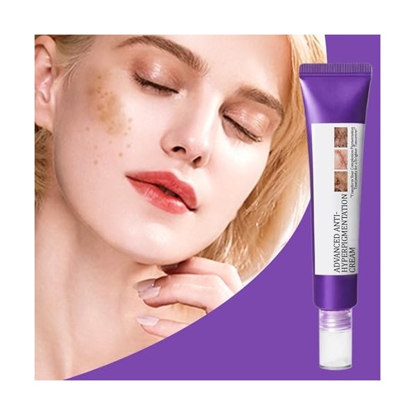 Crème pour le Visage Contre lHyperpigmentation,20g Hydratant Visage Doux | Lotion Hydratante, Produit pour lAtténuation des