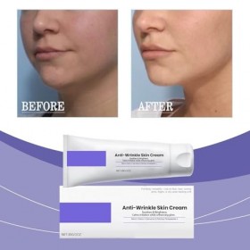 Anti rides Puissant Immediat,Crème Wrinkle Powe,Crème Anti-Rides Pour éliminer Les Ride,Lifting Visage Immediat,Cremes Liftan...