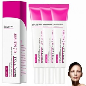 Arbutin 7% + Tranexamic Acid 4% Cream, Creme Eclaircissante Peau Noir Puissant, Even out Tone, Anti-Pigmentation, Black Spot ...