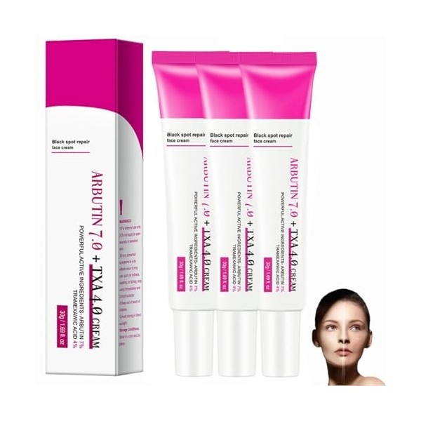 Arbutin 7% + Tranexamic Acid 4% Cream, Creme Eclaircissante Peau Noir Puissant, Even out Tone, Anti-Pigmentation, Black Spot ...