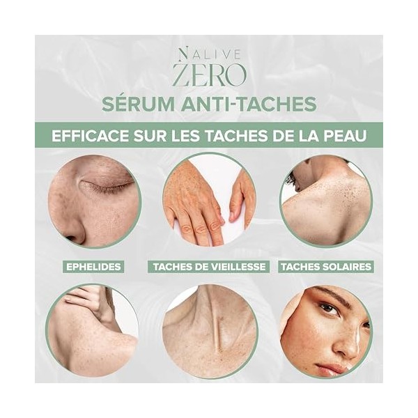 ZERO Nalive – Crème Anti-Taches Visage et Corps - Fabriqué en Italie - Sérum Éclaircissant avec Vitamine C, B3, E & Aloe Vera