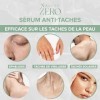 ZERO Nalive – Crème Anti-Taches Visage et Corps - Fabriqué en Italie - Sérum Éclaircissant avec Vitamine C, B3, E & Aloe Vera