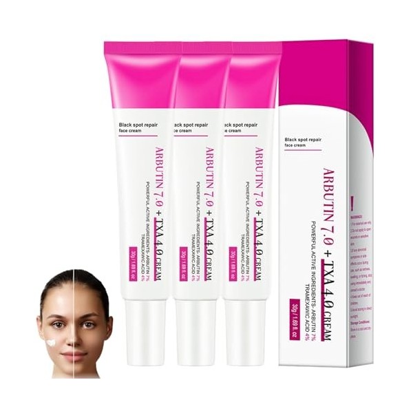 Arbutin 7% + Tranexamic Acid 4% Cream,Creme Eclaircissante Peau Noir Puissant,Black Spot Repair Face Cream,Serum Anti Tache V...
