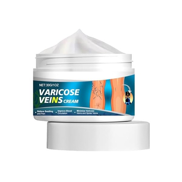 KOAHDE Creme Anti Varices Crème pour Varices,Varices Crème,Varices Jambes Crème,30G,1PC
