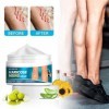 KOAHDE Creme Anti Varices Crème pour Varices,Varices Crème,Varices Jambes Crème,30G,1PC