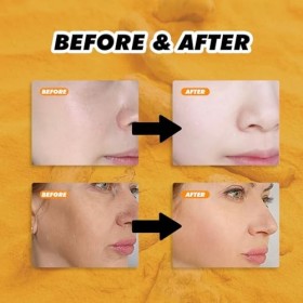 Turmeric Brightening Face Cream,Brightening Cream Turmeric Face,Turmeric Face Repair Cream,Anti-Wrinkle,Facial Moisturizer