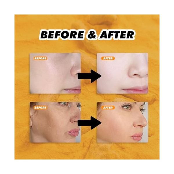 Turmeric Brightening Face Cream,Brightening Cream Turmeric Face,Turmeric Face Repair Cream,Anti-Wrinkle,Facial Moisturizer
