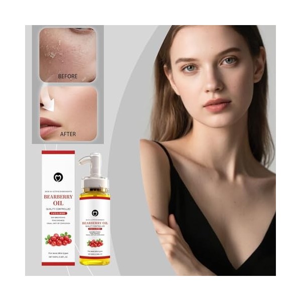 Huilé De Busserole Eclaircissante Peau Noire,Alpha Arbutin Dark Spot Correcting Glow Serum,Huilé Pour Éclaircissant La Péau F...